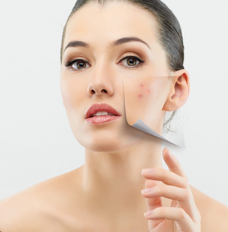 vitamin-a-an-effective-acne-treatment-aihcp